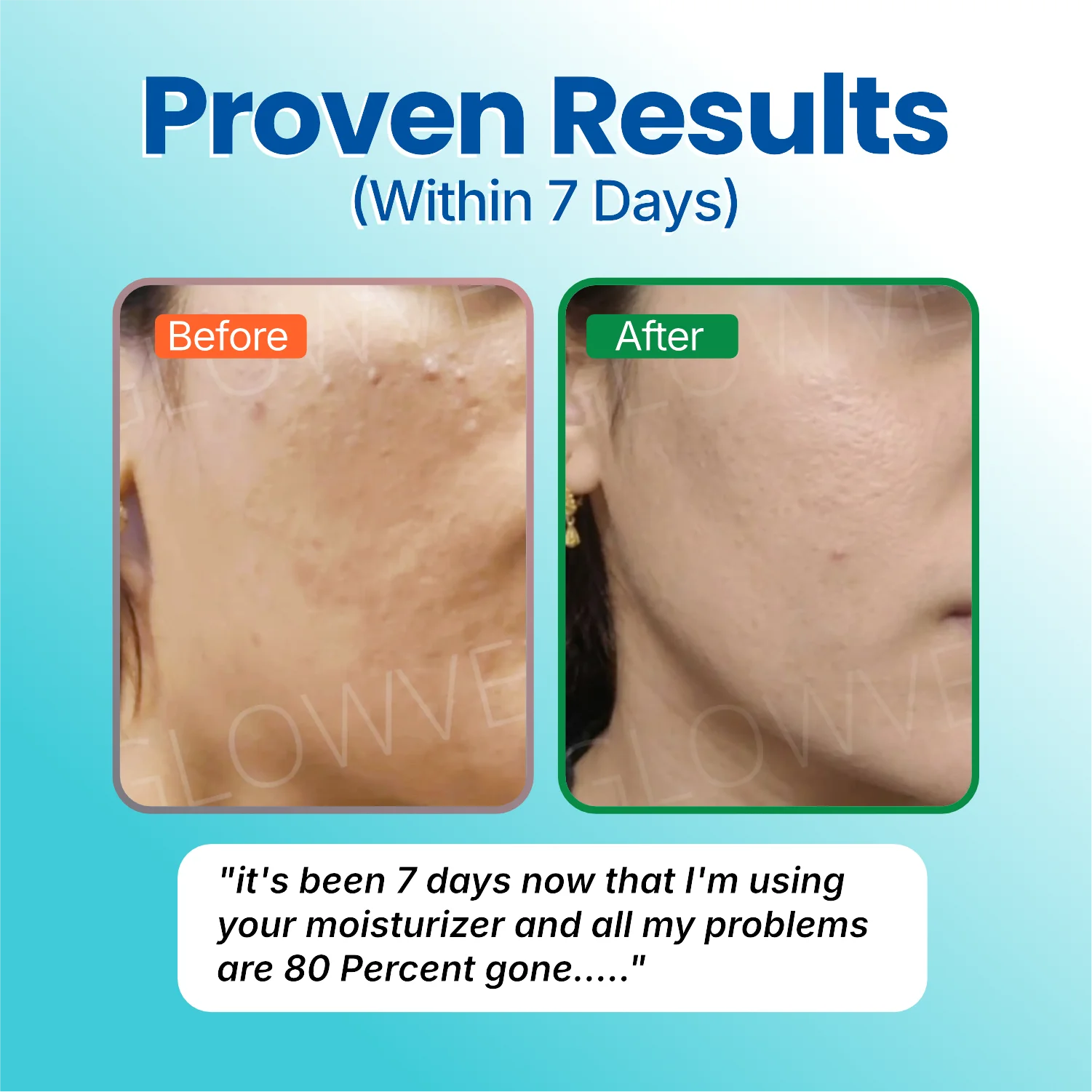 Before and after photo from a customer using Soft Reset for seven days, showing calmer skin with fewer marks on the cheek